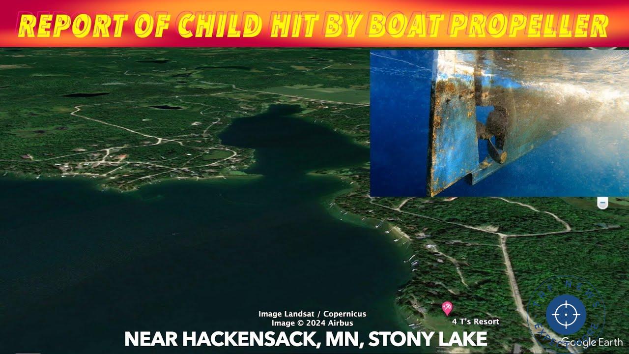 Breaking News: Child Injured by Boat Propeller near Hackensack, Minnesota