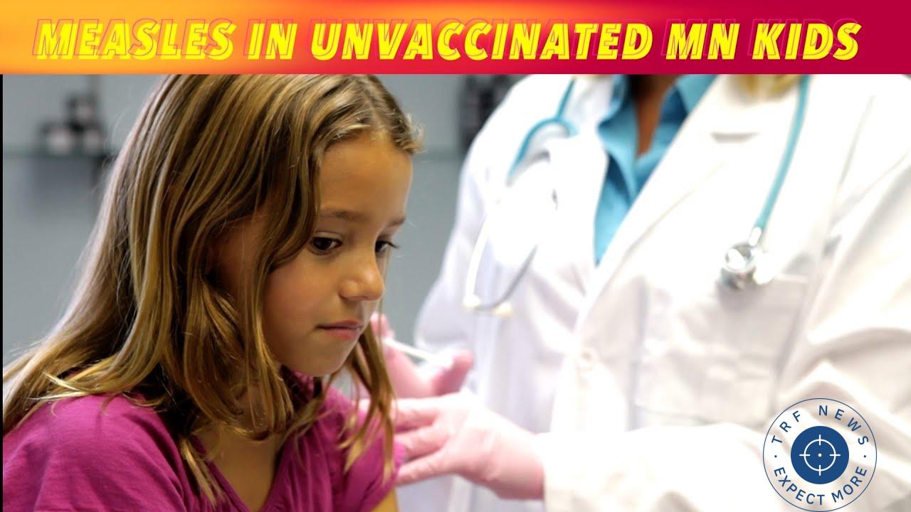 Measles Alert: Unvaccinated Minnesota Children at Risk as Cases Surge