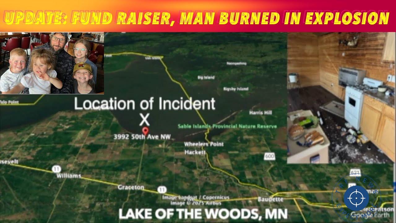 CJ Davis Suffers Severe Burns in Lake of the Woods Accident, GoFundMe Page Set Up