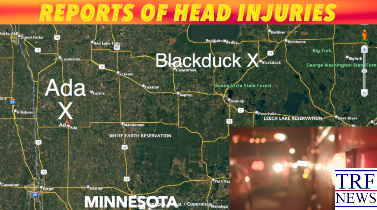 Two Overnight Head Injury Calls in NW Minnesota