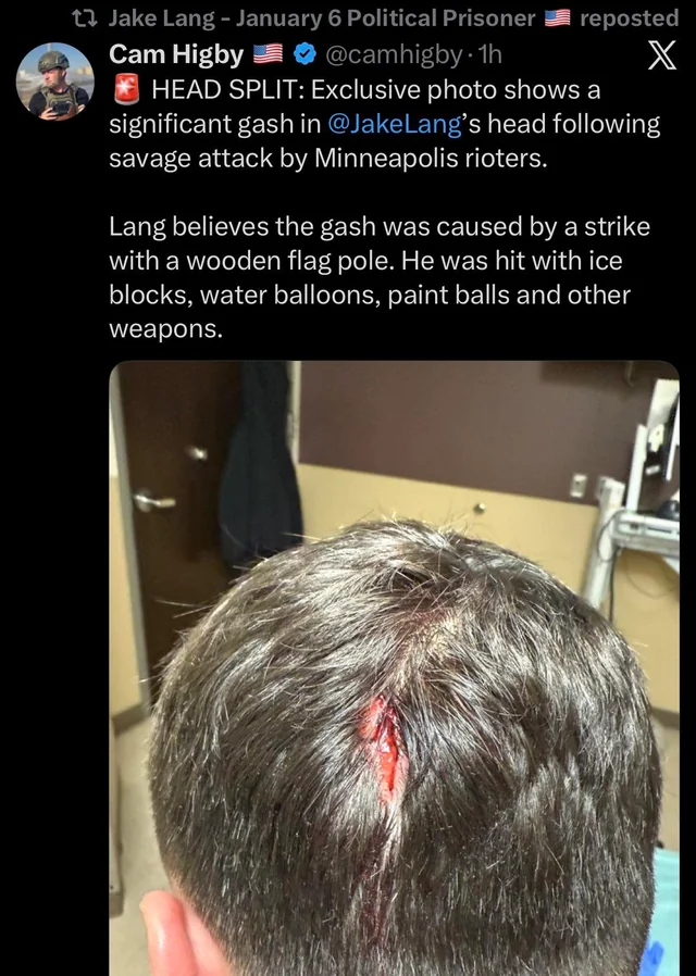 Minneapolis City Hall Rally Clash Injures Jake Lang