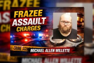 Frazee Man Charged After Cheekbone Fracture